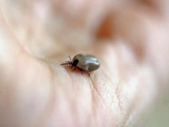 Już 5 przypadków boreliozy. Pogoda sprzyja kleszczom