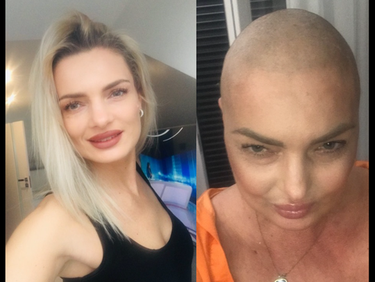 Kiedy kaszel okazał się białaczką. Trwa dramatyczna walka Moniki ZBIÓRKA Kiedy kaszel okazał się białaczką. Trwa dramatyczna walka Moniki ZBIÓRKA