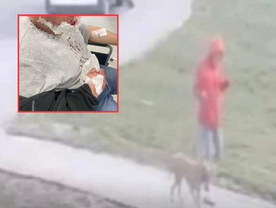 Kolejny atak psa. Policja szuka tego człowieka