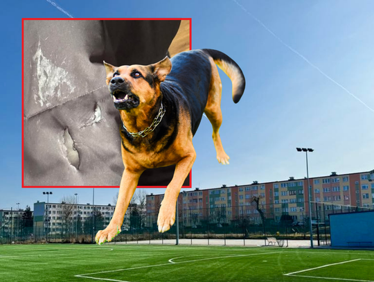 KOLEJNY atak psa w rejonie orlika? Mieszkanka apeluje o patrole KOLEJNY atak psa w rejonie orlika? Mieszkanka apeluje o patrole