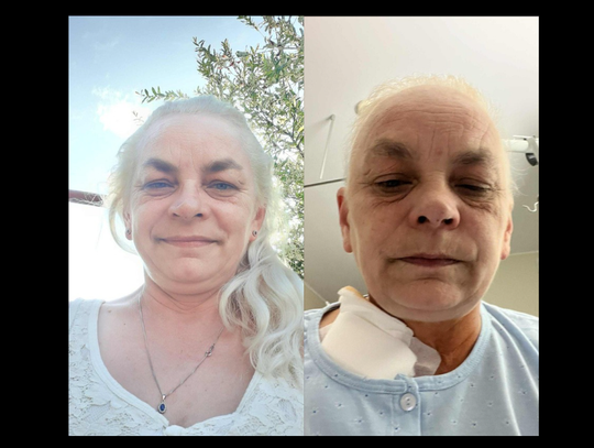 Diagnoza, która zmieniła wszystko. Beata potrzebuje wsparcia ZBIÓRKA