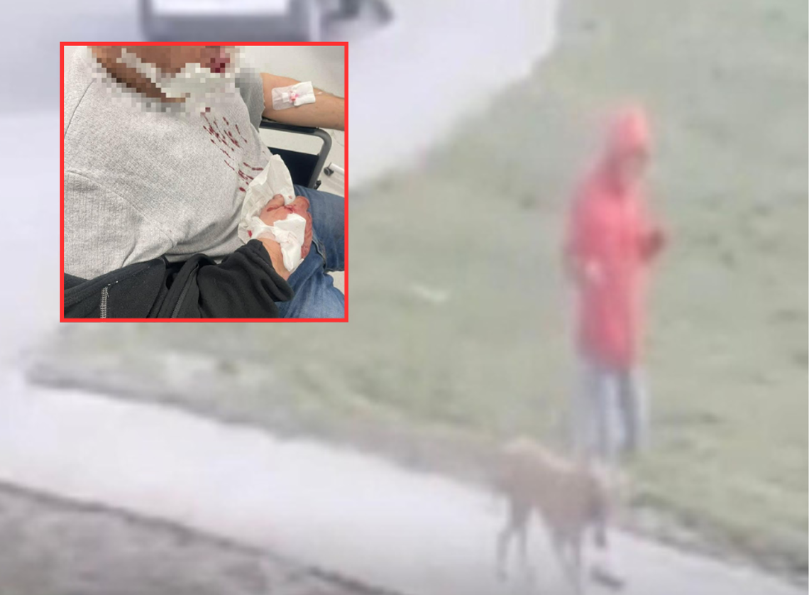 Kolejny atak psa. Policja szuka tego człowieka