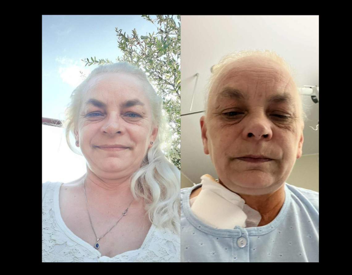 Diagnoza, która zmieniła wszystko. Beata potrzebuje wsparcia ZBIÓRKA